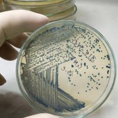 Bacteria in a petri dish