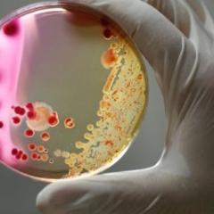Petri dish