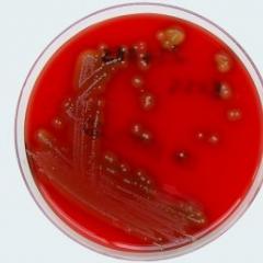 Strep A